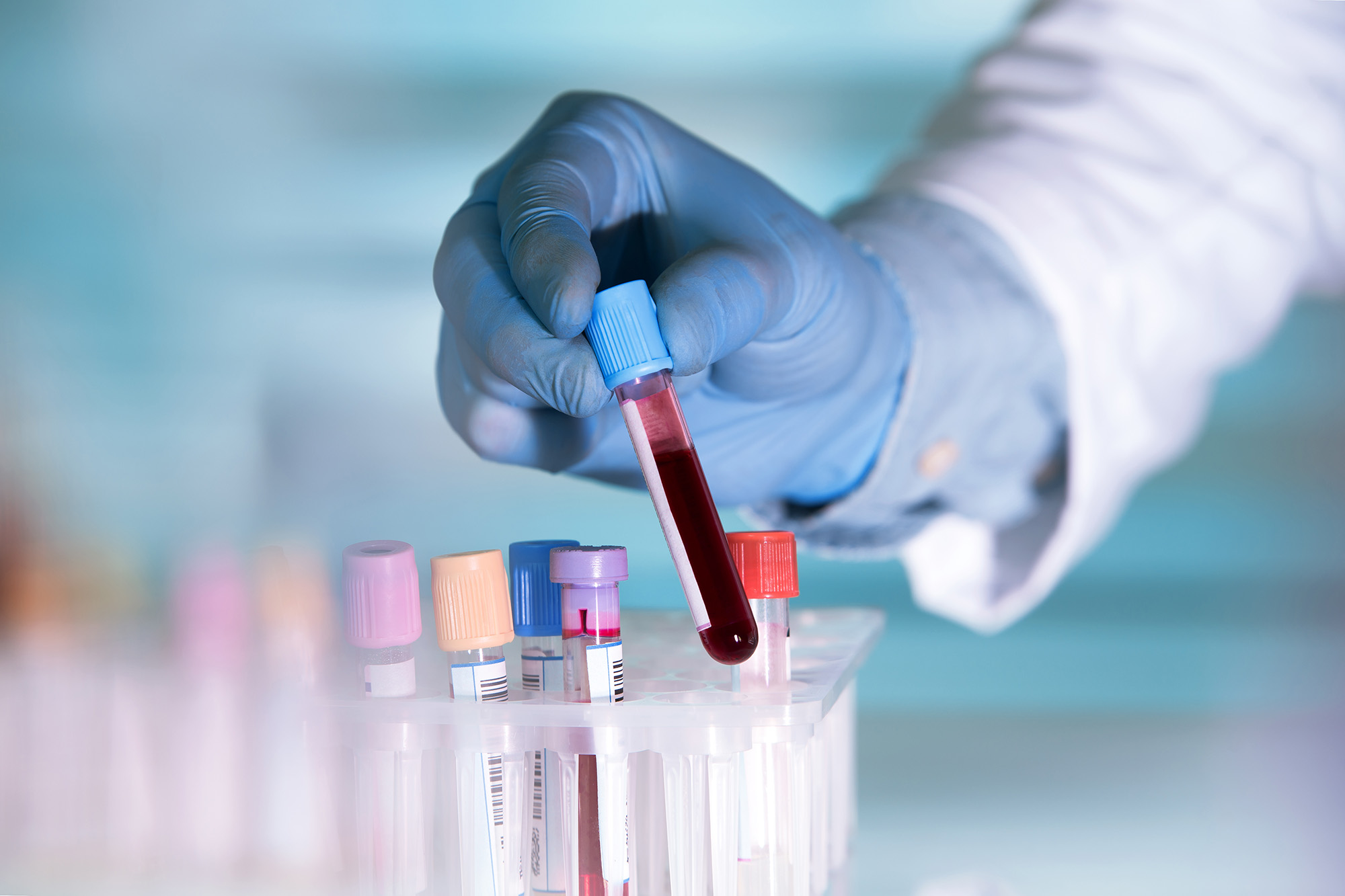 Onsite Health Diagnostics now offering COVID-19 Antibody Testing ...